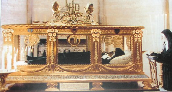 Bronze Casket